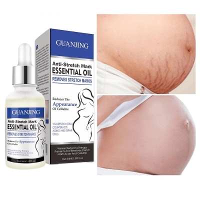 Anti-Stretch Mark ESSENTIAL OIL REMOVES STRETCH MARKS